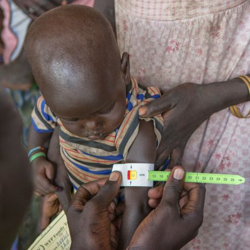 CARE behandelt mangelernährte Kinder in Gesundheitszentren. (Foto: CARE/Dan Alder)